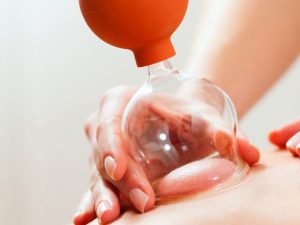 Read more about the article Schröpfen und Schröpfmassage