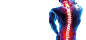 Read more about the article Was ist eine Wirbelfraktur?