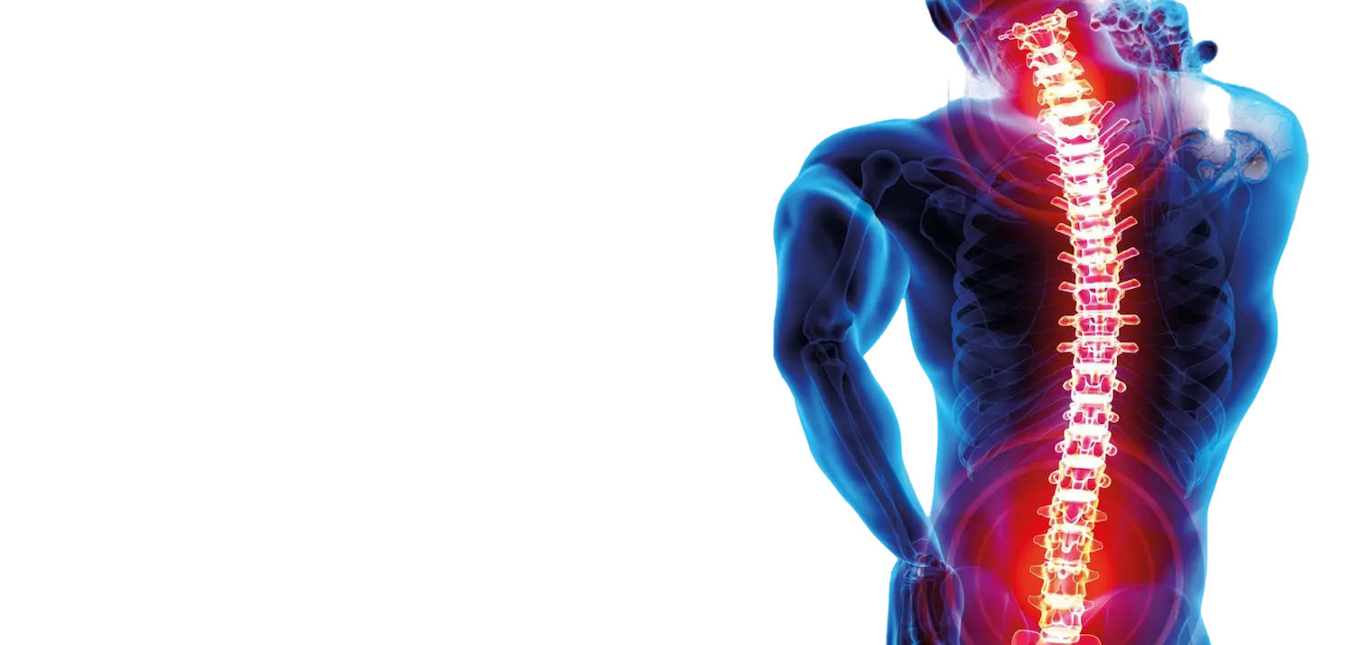 Read more about the article Was ist eine Wirbelfraktur?