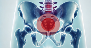 Was ist eine Belastungsinkontinenz?